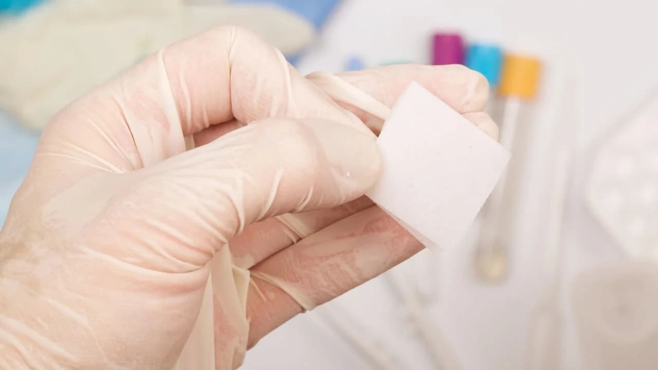 酒精棉片能清散熱膏嗎?